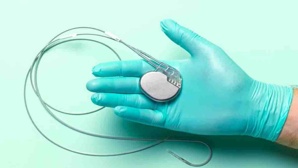 عمل باتری قلب دکتر تبریزی فوق تخصص اریتمی قلب