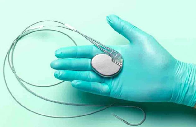 عمل باتری قلب دکتر تبریزی فوق تخصص اریتمی قلب